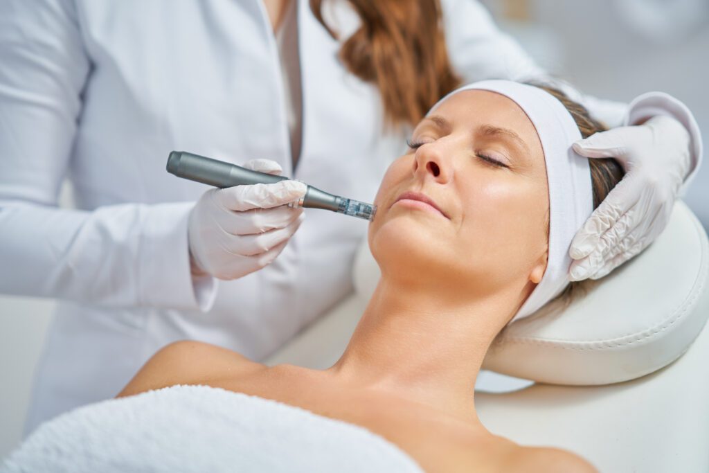 microneedling treatment in Greenville Med Spa, South Carolina