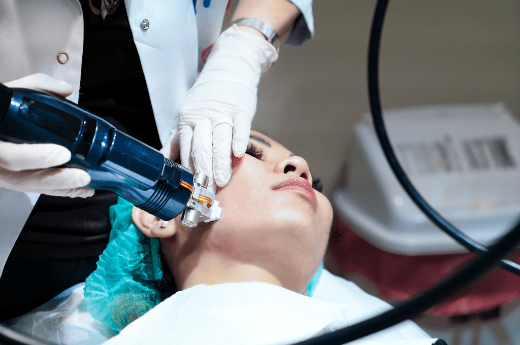 microneedling-for-skin-tightening