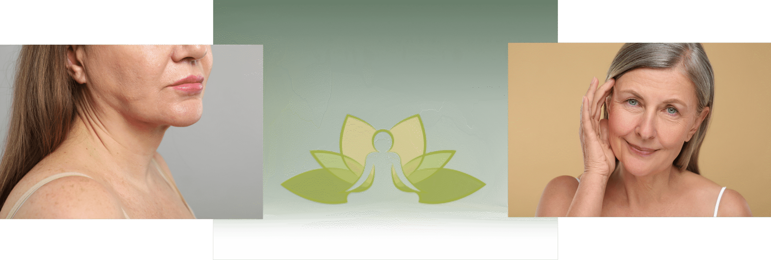 Sculptra treatment in Greeneville, SC